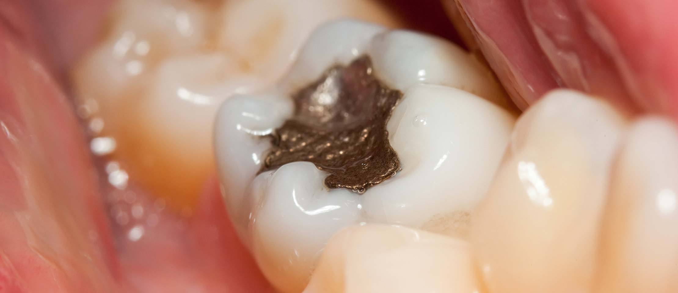 dentisterie biologique